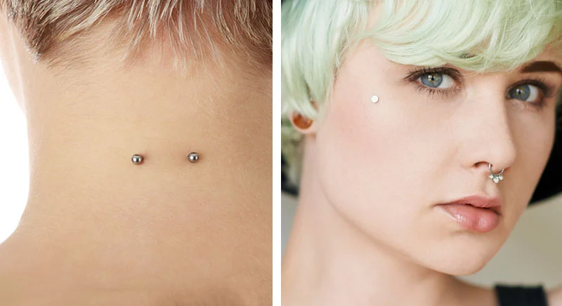 dermals